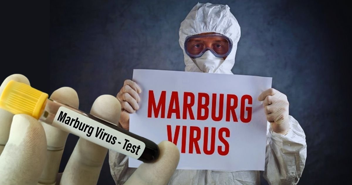 Marburg virüsü